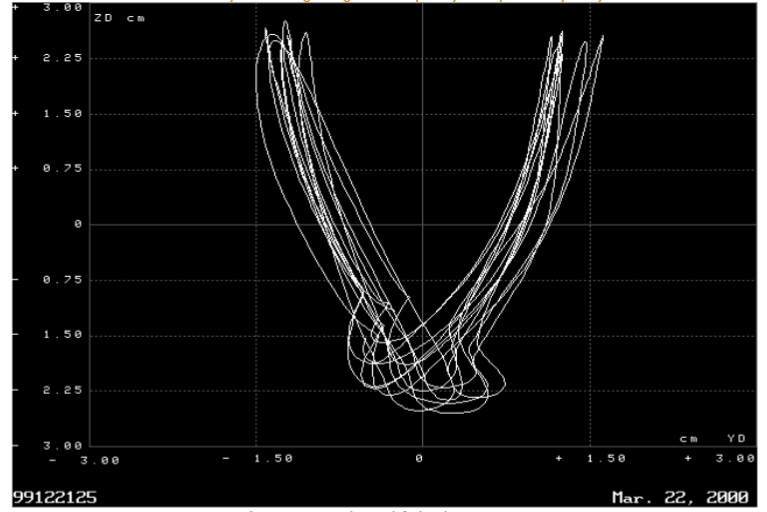 Fig 1: Neutral- no lift looking anterior to posterior