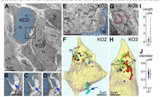 Figure 3. Adjacent herniated and non-herniated neurons show distinct ultrastructural characteristics of mitochondria. (A) Two neurons from the intermediate zone of CB1R-/- embryo indicated as cells number KO2 and KO3 (dotted lines designate their plasma membranes). Cell KO2 exhibits PNH whereas KO3 shows an intact nucleus. (B-D) Serial images of PNH from the framed area in (A). The chromatin stream (blue arrows) herniated from the nucleus (pseudo-colored blue) penetrates the intercellular space. Scale bar in (B) is valid for (C) and (D). (E-H) High power images (E) and (G) and 3D reconstructions (F) and (H) of the cells KO2 and KO3. 20 randomly selected mitochondria from each cell are shown in different colors in the 3D reconstructions. Cell KO2 exposing PNH (blue arrow) contains mostly short or spherical mitochondria, whereas several mitochondria from cell KO3 are long. Nuclei profiles are traced violet. Abbreviations: cv, cilial vesicle; ger, granular endoplasmic reticulum; m, mitochondria, mc, mother centriole; N, nucleus. (I, J) Estimation plots of lengths and diameters for mitochondria from cells KO2 (blue) and KO3 (white). The figure was published in our article 31.