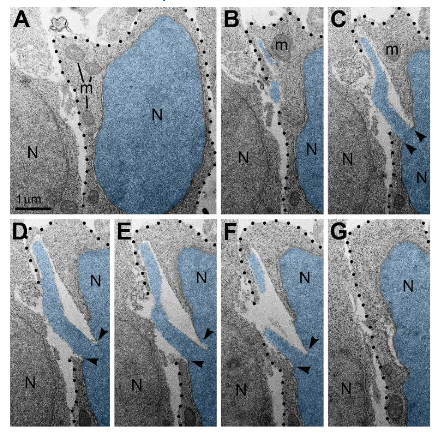 Figure 4. An example of plasma membrane rupture blocked by adjacent cell. (A-G) Serial electron micrographs depict a neuron with PNH from the cortical plate of wild type mouse embryo exposed to CB1R agonist WIN 55,212-2. The nucleus (N) and PNH stream are pseudo-colored blue. Points of interruption of NE are indicated with arrowheads. The plasma membrane is designated with dotted lines. Although the nuclear hernia produces a large rupture of the plasma membrane, the cellular cytoplasm does not show evidence of degradation and mitochondria (m) do not show evidence of swelling. Scale bar in (A) is valid for all. The figure was published in our article 31.
