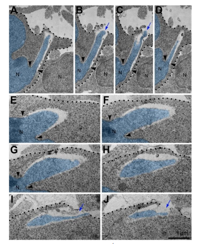 Figure 2. Long length and large volume of herniated chromatin streams are evidence of high intranuclear pressure destroying NE. (A-D) Serial micrographs of PNH in a neuron from the cortical plate of CB1R-/- embryo show continuum of the chromatin stream expelled from the nucleus (N; pseudo-colored blue) and penetrating the intercellular space. (E-J) Representative set of serial micrographs of PNH in a neuron from the cerebral intermediate zone of an embryo exposed to WIN-55,212-2. Volume of the herniated chromatin stream was estimated in the complete series of 31 sections as 1.63 μm3. Blue arrows in (B), (C), (I) and (J) denote the interruption of the plasma membranes, which are designated with dotted lines. Points of NE interruption in (A-G) are indicated with arrowheads. Scale bar in (J) is valid for all. The figure was published in our article 31.