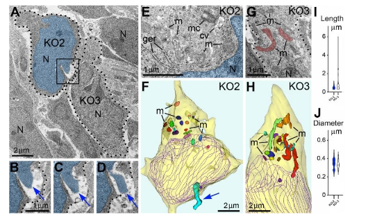 Figure 3. Adjacent herniated and non-herniated neurons show distinct ultrastructural characteristics of mitochondria.