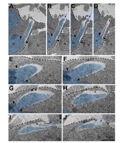 Figure 2. Long length and large volume of herniated chromatin streams are evidence of high intranuclear pressure destroying NE.