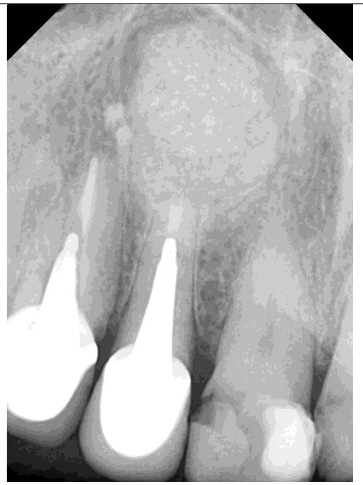 Control x-ray 7 days post-op
