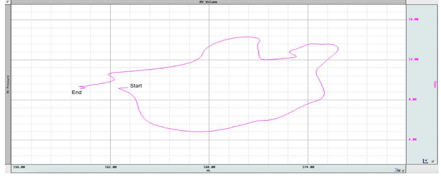 Gasping effect on right (top) and left (bottom) ventricles pressure-volume loops (Pourzand et al. Circulation. 2024; 150.suppl_1.Sa201).