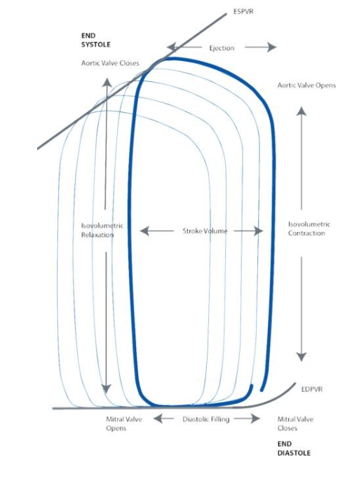 A schematic of pressure-volume loop under normal physiologic conditions (CD Leycom, Hengelo, Netherlands).