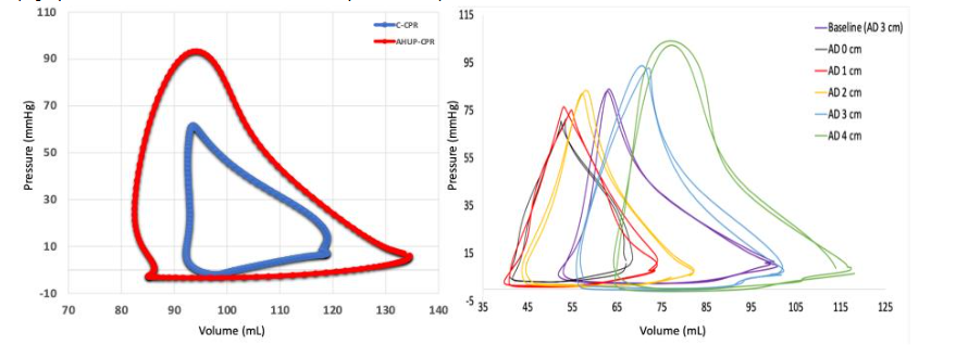 A comparison between pressure-volume loops generated in the right ventricle by conventional CPR vs automated head-up CPR (left). Effect of different levels of active decompression (AD) on pressure-volume loops in the right ventricle (right; Pourzand et al. Resuscitation. 2024; 110-3-24).