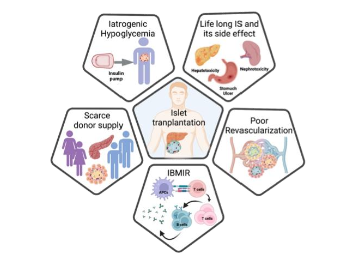 Figure 1: Illustration of islet transplantation and current challenges: Insulin dysregulation-Iatrogenic hypoglycemia, life-long immune suppression and its side effect, poor revascularization, instant blood mediated inflammatory reaction (IBMIR) and scarce donor supply.