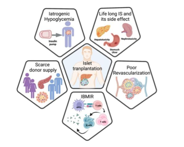 Figure 1: Illustration of islet transplantation and current challenges: Insulin dysregulation-Iatrogenic hypoglycemia, life-long immune suppression and its side effect, poor revascularization, instant blood mediated inflammatory reaction (IBMIR) and scarce donor supply.