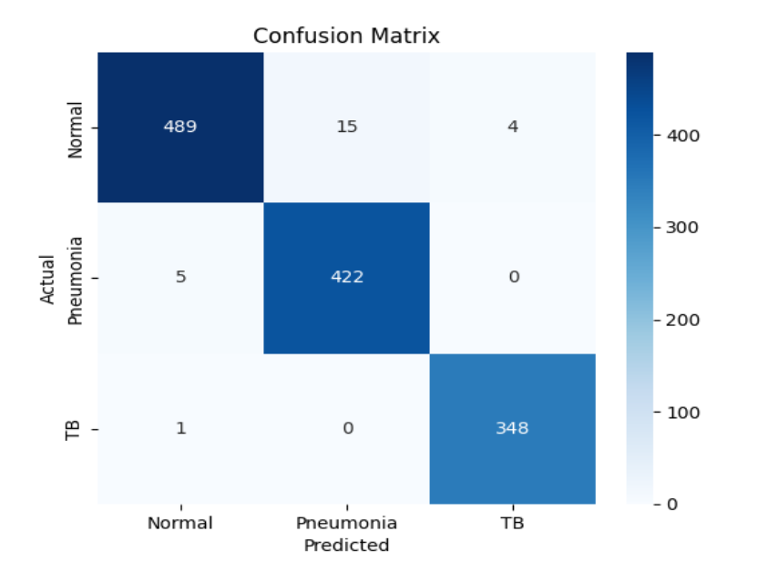Figure 4: Confusion matrix for the ensemble model on the test set. The confusion matrix provides a detailed breakdown of the ensemble model’s predictions versus the true labels for each class (Normal, Pneumonia, Tuberculosis). High values along the diagonal indicate that most samples were correctly classified in their respective categories. The matrix reveals that the ensemble achieves strong sensitivity and specificity for all three classes, with particularly few misclassifications for the TB class, a critical outcome for public health. Off-diagonal entries are minimal, suggesting that the model rarely confuses pneumonia with TB or normal cases, and vice versa. This indicates robust discrimination capability, even between classes with overlapping radiographic features.