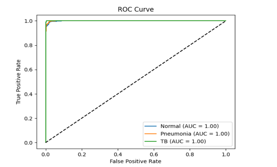 Figure 5: ROC curves for the ensemble model for each class. The ROC curves show the relationship between true positive rate (sensitivity) and false positive rate (1-specificity) for each class, across all possible decision thresholds. The area under the curve (AUC) is close to 1.0 for all classes, indicating excellent model performance and a high ability to distinguish between positive and negative cases. The steep initial rise and high AUC for TB and pneumonia suggest that the ensemble model is highly effective at identifying these diseases with few false positives, which is essential for clinical deployment and reducing unnecessary follow-up procedures.