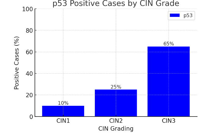 Figure 3: Bar chart showing the percentage of p53 positive cases across different CIN grades (CIN1, CIN2, CIN3). p53 expression compared in patients with CIN1 vs CIN2 and CIN2 vs CIN3. p<0.0001 in both cases.