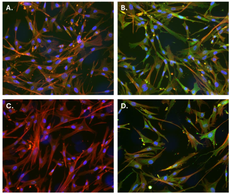 Figure 1: Immunofluorescent detection of p53 protein in chicken corneal epithelial cells. Representative images of CCEC stained with two different α-human p53 antibodies A.- B. PAb 421 or C.-D. Biotium 2092R. Green fluorescence corresponds to p53 staining, red indicates actin filaments (647-phalloidin), and blue points to nuclear DNA (DAPI). Slides were further stained with either a Cy3-AffiniPure Gα-R IgG (111-165-047, Jackson), or Cy™3 AffiniPure® Goat Anti-Mouse IgG F(ab’)2 Fragment Specific (111-165-166). A. and C. represent controls (no primary antibodies), while B. and D. show positive staining for p53 in the cytoplasmic compartment.