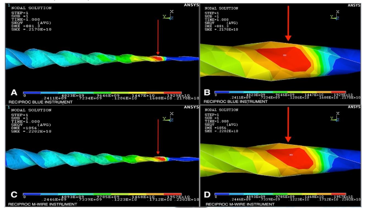 Figure 1: Torsion Miss stress determined using Ansys Software for Reciproc Blue (A and B) and Reciproc M-Wire instruments.