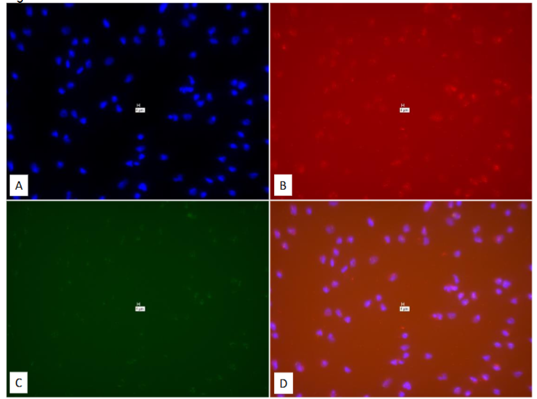 Figure 32: Pure culture of eukaryotic cells (Mouse RAW264 NIH 93 cells.) “With-Probe” using Affymetrix RNA View® ISH TISSUE Assay Kit.