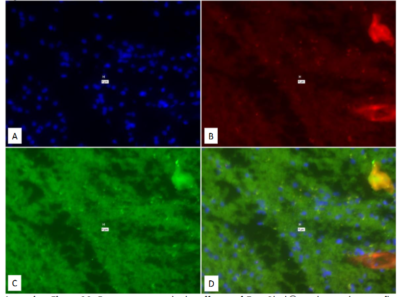 Figure 12: Experiment to study the efficacy of True Black® to obviate the auto-fluorescence.