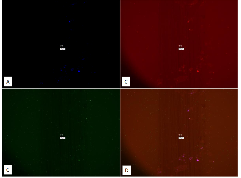 Figure 23: Study on pure culture of M. tb. This is a “No-Probe” control for Figure 22.