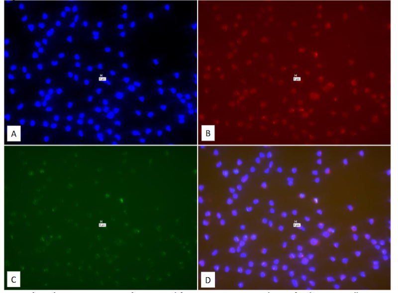 Figure 33: “No-Probe” control for Figure 32. Pure culture of eukaryotic cells (Mouse RAW264 NIH 93 cells.)