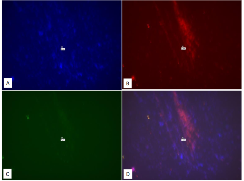 Figure 26: Study on pure culture of M. avium subspecies avium. Different probes than those used in Figure 25.