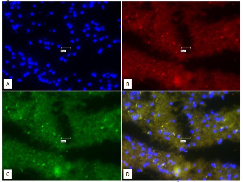 Figure 11: Experiment to study the efficacy of True Black® to obviate the auto-fluorescence.