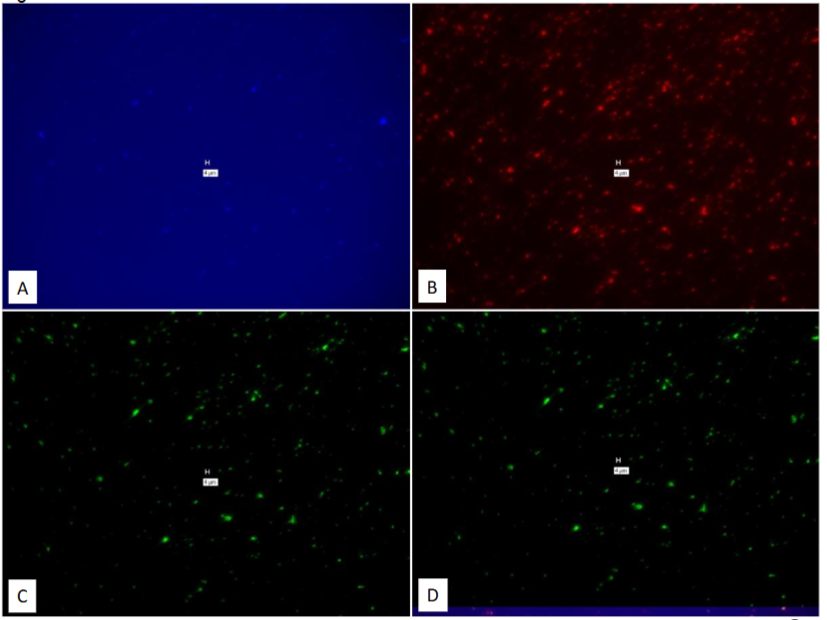 Figure 13: Study on pure culture of BCG “With-Probe” using Affymetrix RNA View® ISH TISSUE Assay Kit.