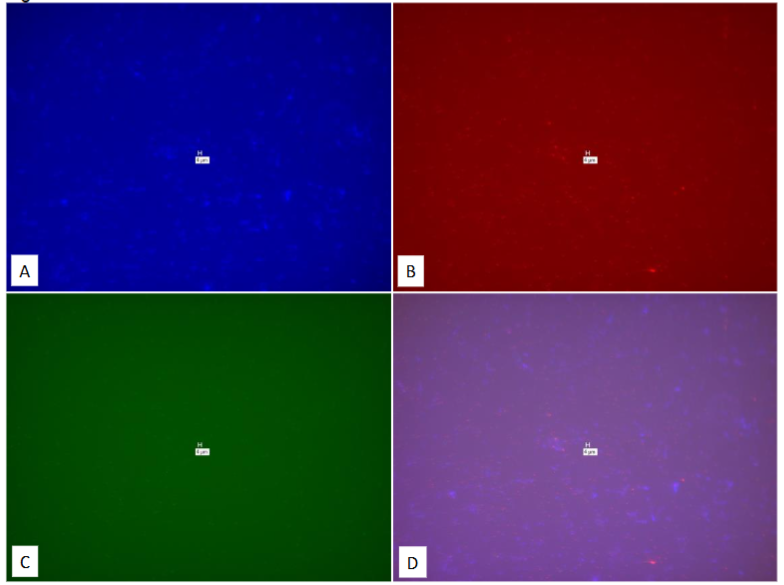 Figure 27: Study on pure culture of M. avium subspecies avium. “No-Probe” control for Figures 25 & 26.