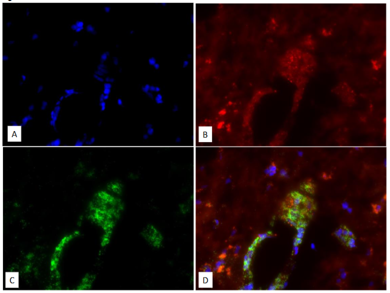 Figure 1: A composite of four images of the same section of human Multiple Sclerosis brain tissue.
