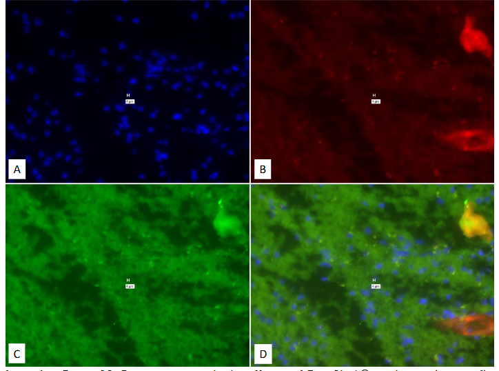 Legend to Figure 12. Study on pure culture of BCG “With-Probe” using Affymetrix RNA View® ISH TISSUE Assay Kit.