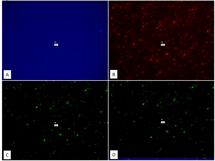 Legend to Figure 13. Study on pure culture of BCG “No-Probe” using Affymetrix RNA View® ISH TISSUE Assay Kit.