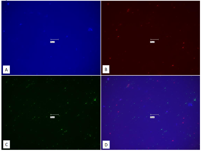Legend to Figure 17. Study on pure culture of E. Coli “No-Probe” control for Figure 16.