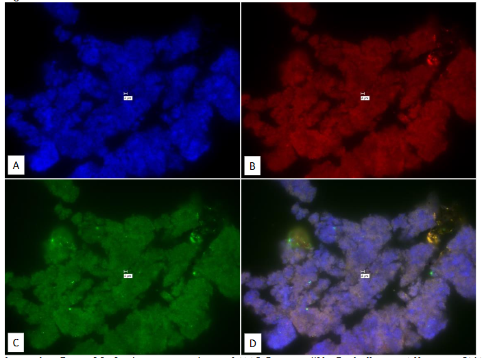 Legend to Figure 18. Study on pure culture of M. tb. “With-Probe” using Affymetrix RNA View® ISH TISSUE Assay Kit.