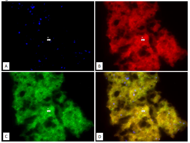 Legend to Figure 7. This is the No-Probe control for Figure 6. Human Multiple Sclerosis brain.