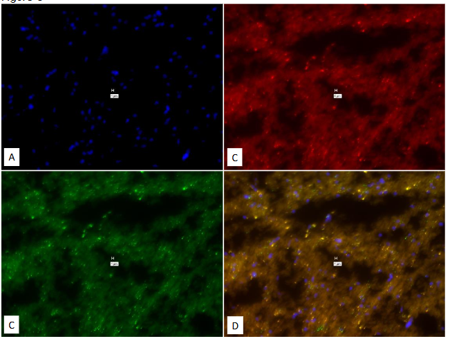 Legend to Figure 8. Experiment to study the efficacy of True Black® to obviate the auto-fluorescence.
