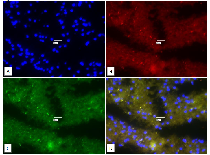 Legend to Figure 11. Experiment to study the efficacy of True Black® to obviate the auto-fluorescence.