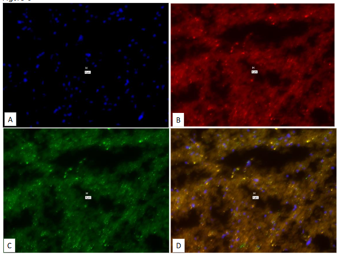 Legend to Figure 3. “No-Probe” negative from a different patient (Pt # 3860; Multiple Sclerosis) but processed identically in the same experiment as in Figures 1 & 2.