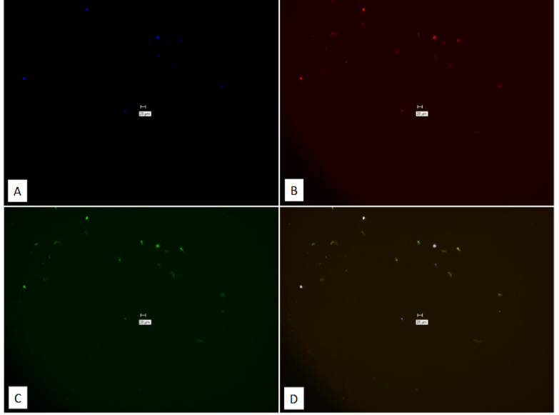 Figure 14: Study on pure culture of BCG “No-Probe” using Affymetrix RNA View® ISH TISSUE Assay Kit.