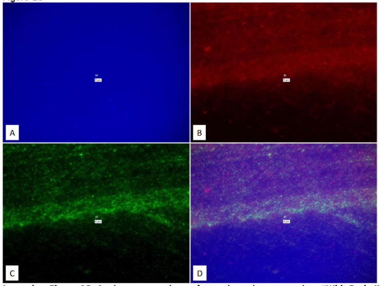 Figure 25: Study on pure culture of M. avium subspecies avium. “With-Probe” using Affymetrix RNA View® ISH TISSUE Assay Kit.