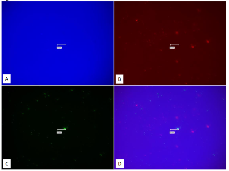 Figure 31: Study on pure culture of MAP Dominic. “No-Probe” comparison of different filters from Figure 26.