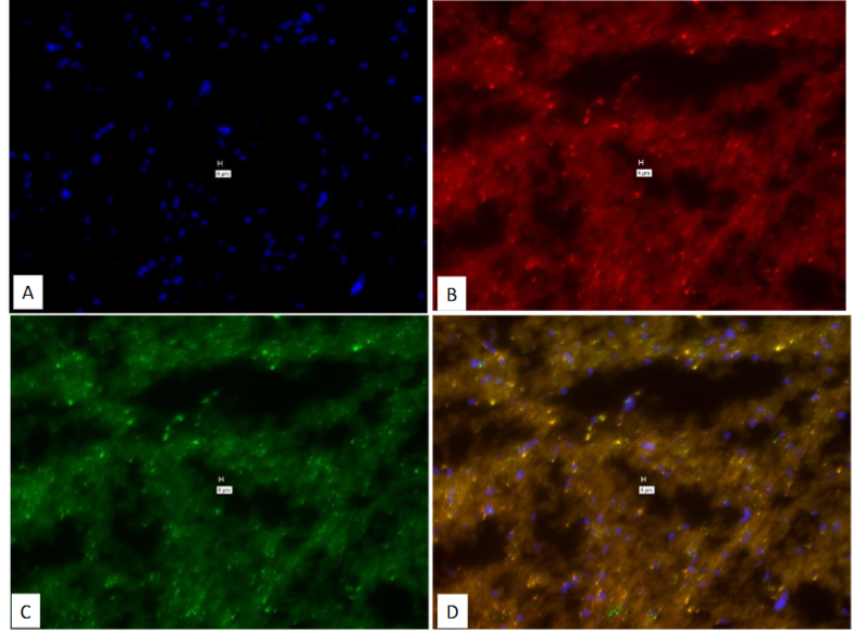 Figure 3: “No-Probe” negative from a different patient (Pt # 3860; Multiple Sclerosis).