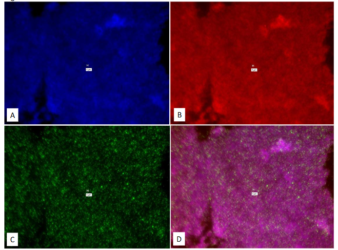 Legend to Figure 19. Study on pure culture of M. tb. This is a “No-Probe” control for Figure 18.