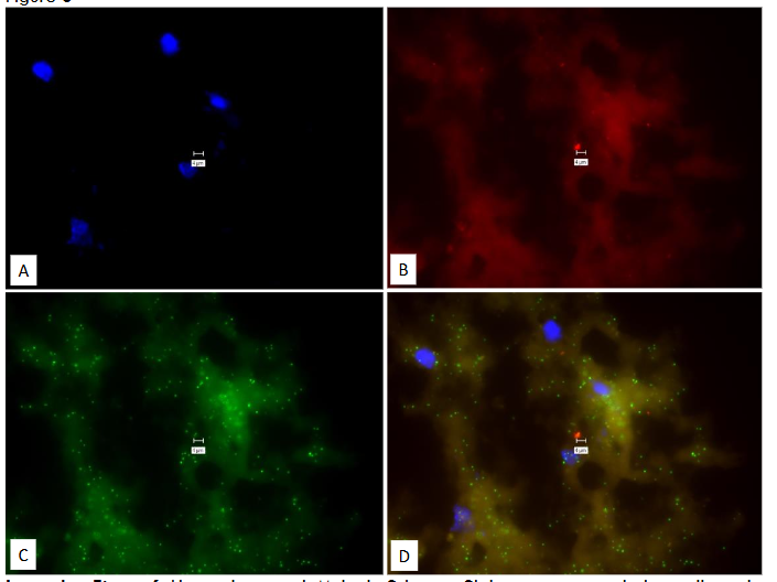 Legend to Figure 6. Human brain with Multiple Sclerosis. Slide was processed identically and in the same experiment as Figures 1, 2 & 3.