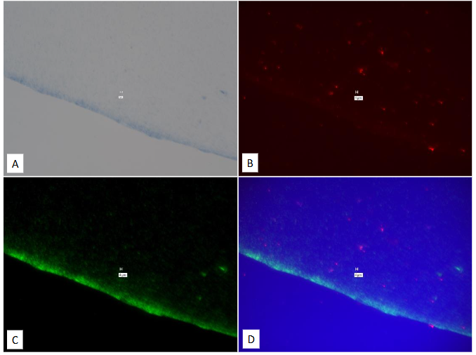 Legend to Figure 16. Study on pure culture of E. Coli “With-Probe” using Affymetrix RNA View® ISH TISSUE Assay Kit.
