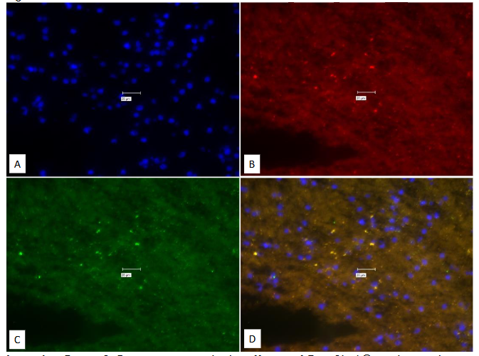 Legend to Figure 9. Experiment to study the efficacy of True Black® to obviate the auto-fluorescence. No-True-Black control with Probes.