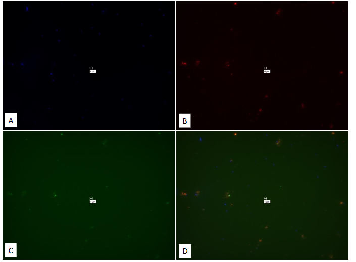 Legend to Figure 21. Study on pure culture of M. avium subspecies avium. “No-Probe” control for Figures 20.