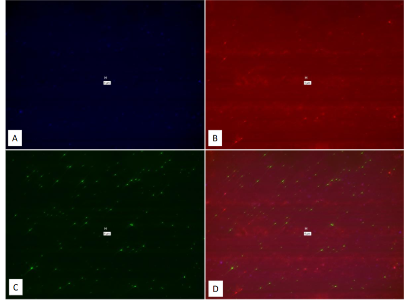 Figure 22: Study on pure culture of M. tb. “With-Probe” using Affymetrix RNA View® ISH TISSUE Assay Kit.