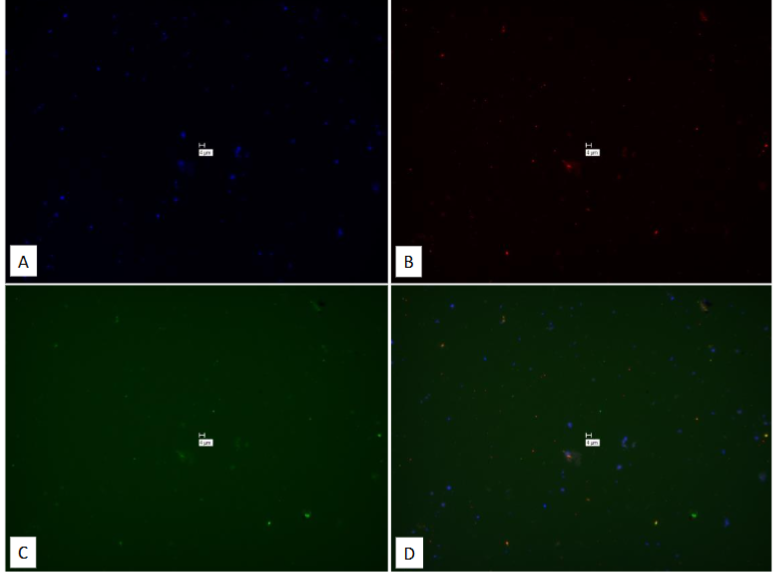 Figure 28: Study on pure culture of M. avium subspecies avium. “No-Probe” control for Figures 25 & 26, using Affymetrix RNA View® ISH CELL Assay Kit.