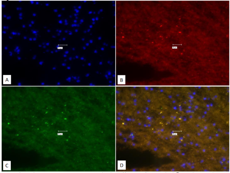 Figure 9: Experiment to study the efficacy of True Black® to obviate the auto-fluorescence.