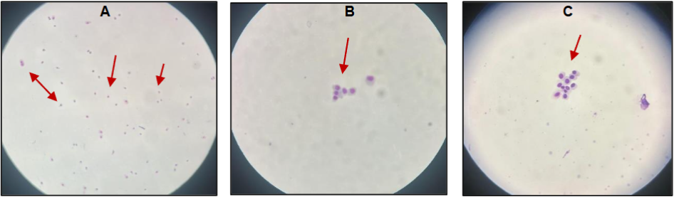 Figure 2 – A: Microscopic image showing the cellularity of the conjunctival mucosa sample, stained with Giemsa technique (40× magnification). B and C: Microscopic images showing conjunctival mucosa epithelial cells (100× magnification).