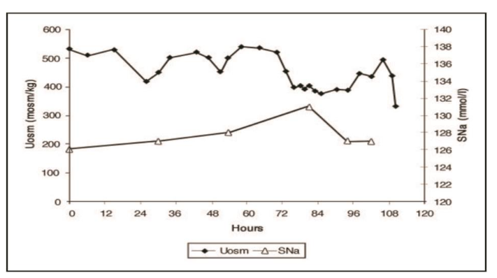 Figure 2A. Graph demonstrating urine osmolality (Uosm) and serum sodium (SNa) concentration in response to infusion of isotonic saline in a patient with SIADH - note failure to excrete dilute urine despite isotonic saline infusion.