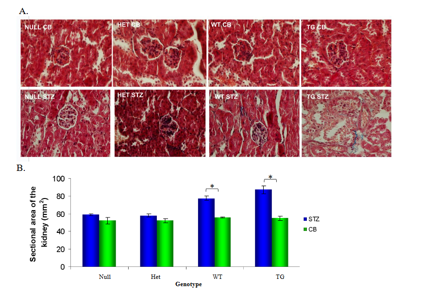 Figure 2. Cross-sectional of kidneys from non-diabetic and diabetic null, heterozygous, wild-type, and HB-EGF transgenic mice. A. H&E staining of individual glomeruli from kidneys (representation of 5 glomeruli of 5 different mice each), B. Total cross-sectional area of kidney, and C. Glomerular cross-sectional area from CB- and STZ-treated null, heterozygous, wild-type, and HB-EGF transgenic mice. Data were analyzed by Student’s T-test and ANOVA (n=10 each), * p< 0.05.