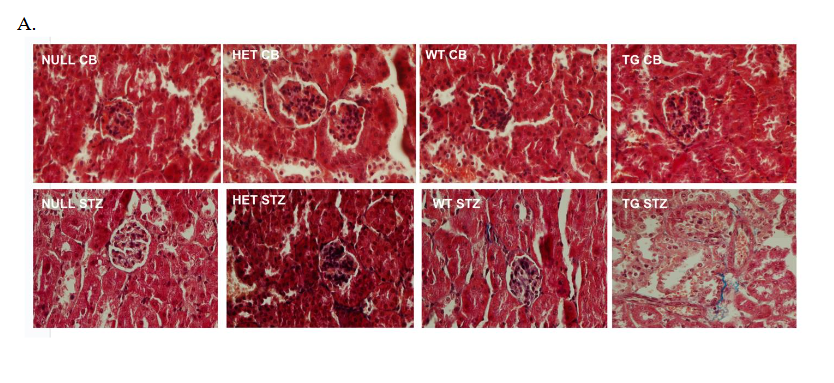 Figure 3. Glomerular analysis of non-diabetic and diabetic null, heterozygous, wild-type, and HB-EGF transgenic mice. A. Masson’s trichrome staining of CB- and STZ-treated null, heterozygous, wild-type, and HB-EGF transgenic mice (representation of 5 glomeruli of 5 different mice each). B. Mean number of glomerular nuclei per glomeruli area from CB- and STZ-treated null, heterozygous, wild-type, and HB-EGF transgenic mice (representation of 5 glomeruli of 5 different mice each). Data were analyzed by Student’s T-test. * p< 0.05.